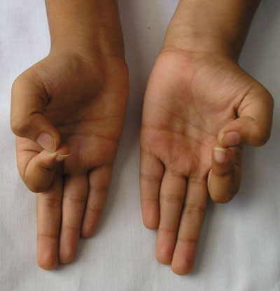 Mudra Holding Your Hand In This Position Does Something Incredible For Your Body -Here’s How 1