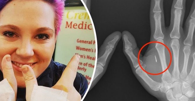 Australia Becomes World’s Most Microchipped Nation – Your News Wire